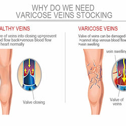 Varicose Veins Compression Socks for Sports & Travel