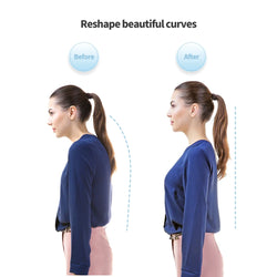 Smart Posture Corrector with Real-Time Feedback